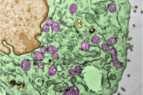 Electron micrograph of mitochondria (pink/purple color) from cancer cells resistant to immune checkpoint inhibitors