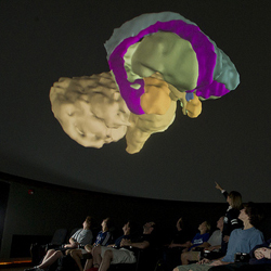 Students view images of the brain in the DVT
