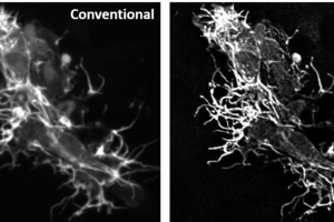 Open-source application creates super-resolution images of cell development in living animals