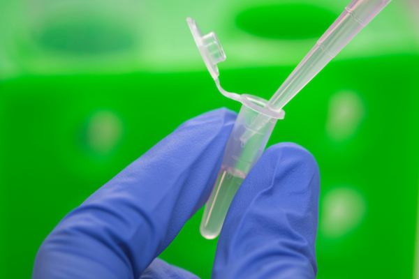 Fingers wearing blue gloves hold clear pipette, blurred green background