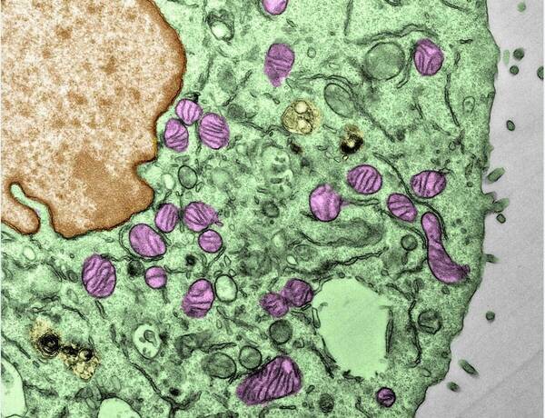 Electron micrograph of mitochondria (pink/purple color) from cancer cells resistant to immune checkpoint inhibitors